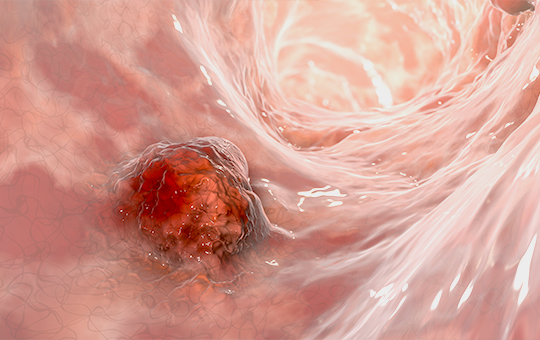 베스트장내과 인공지능 내시경 이미지