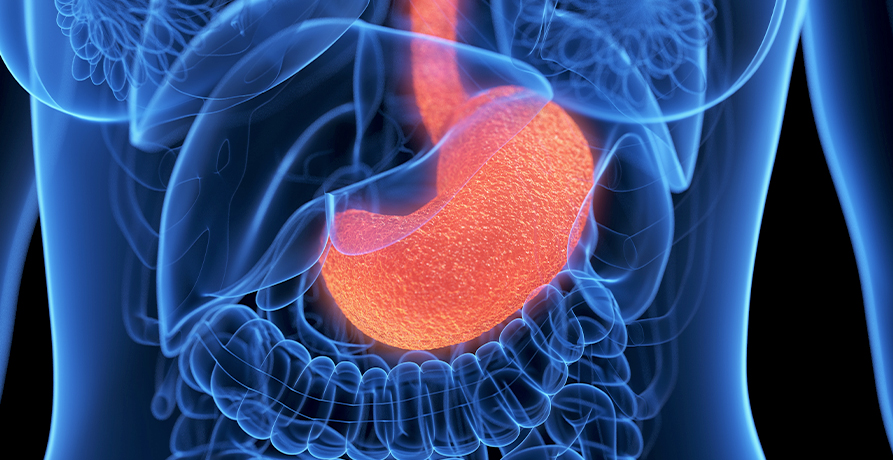 베스트장내과 위내시경 이미지