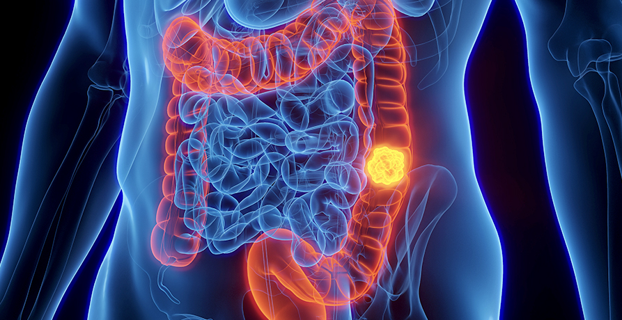 베스트장내과 장내시경 이미지