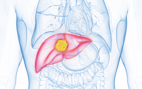 베스트장내과 간암 검진