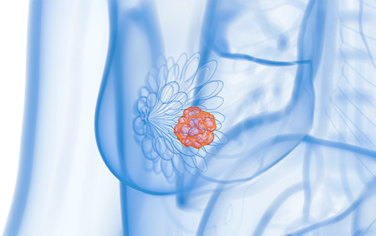 베스트장내과 유방암 검진