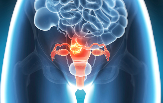 베스트장내과 자궁경부암 검진